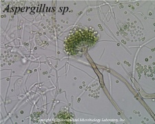 Aspergillus oryzae